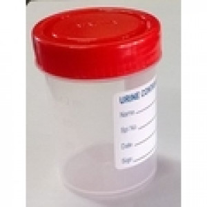 Urine Collection Container