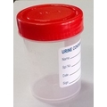 Urine Collection Container