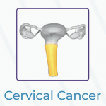 woman cancer hospital