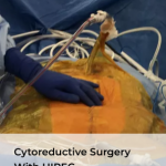 Providing specialized cancer care