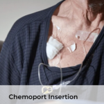 Providing specialized cancer care