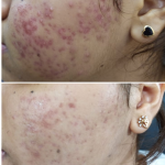 Pancham skin, hair & laser treatment