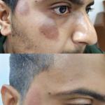 Pancham skin, hair & laser treatment