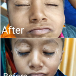 Pancham skin, hair & laser treatment