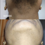 Pancham skin, hair & laser treatment