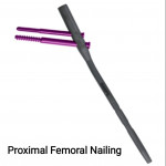 Orthopedic implants & Instruments