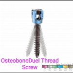 Orthopedic implants & Instruments