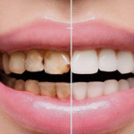 Dental care & implant center